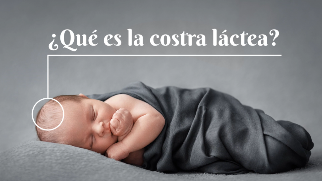 Imagen de la cabecera del post de costra láctea